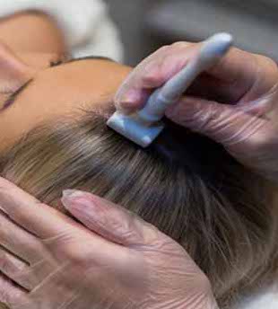 Scalp treatment